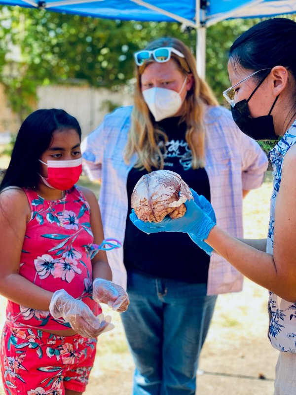 Yangmiao holding a brain